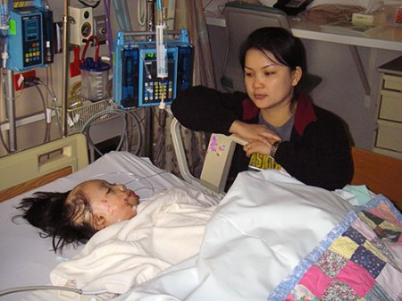 Boun Lod with her mother after her second surgery.