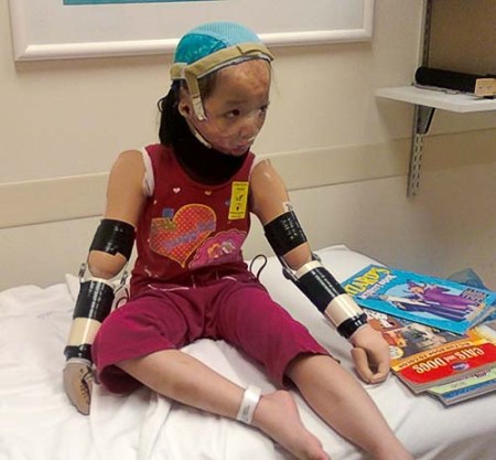 Boun Lod with her arms and face mask.