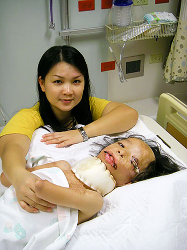 Boun Lod and Noi after the November Surgery