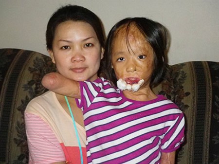 Noi and Boun Lod. Feeling Better Already.